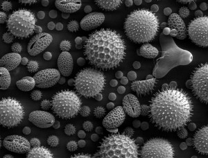 Electron microscope picture of pollen